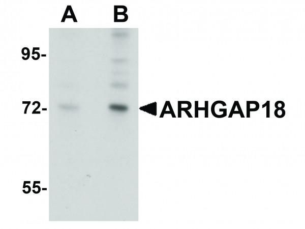 Anti-ARHGAP18