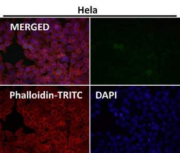 Anti-phospho-ULK1 (Ser556) / Unc-51 like autophagy activating kinase 1, clone 31U30