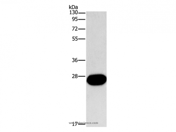 Anti-FGF9