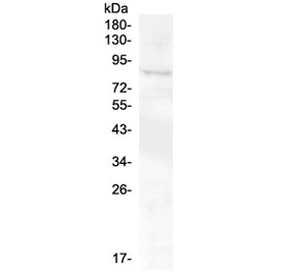 Anti-RXFP2 / Relaxin Receptor 2