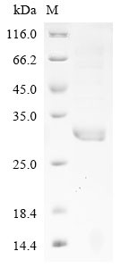 Creatine kinase (CKM), partial, horse, recombinant