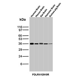 Anti-FOLR1 / Folate receptor 1, clone FOLR1/12910R