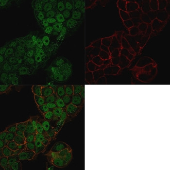 Anti-CHD4 / Chromodomain helicase DNA binding protein 4, clone 3F2/4