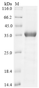 Ubiquitin carboxyl-terminal hydrolase 6 (USP6), partial, human, recombinant