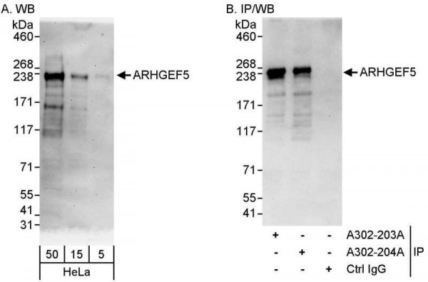 Anti-ARHGEF5