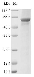 Propionyl-CoA carboxylase beta chain, mitochondrial (PCCB), recombinant human