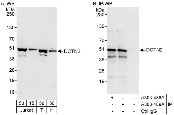 Anti-DCTN2