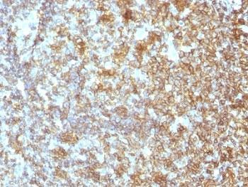 Anti-CD45 (Leukocyte marker), clone SPM496