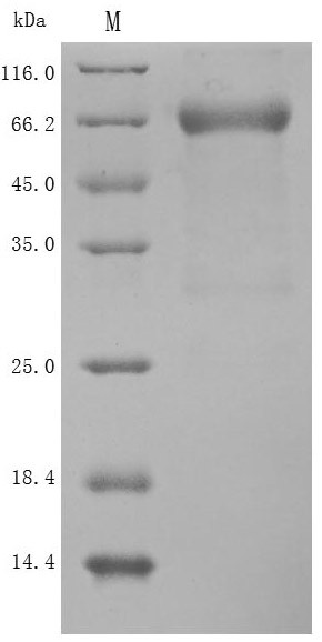 Semaphorin-4D (SEMA4D), partial (Active), human, recombinant