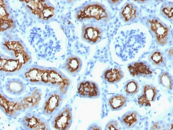 Anti-CFTR / Cystic Fibrosis Transmembrane Regulator, clone CFTR/1342
