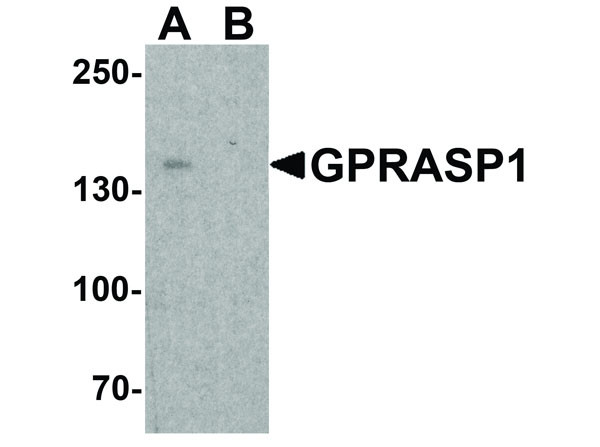 Anti-GPRASP1