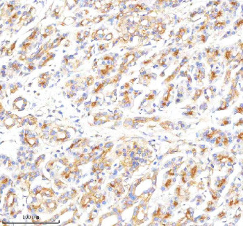 Anti-CLTB / Clathrin light chain B