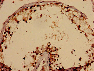 Anti-TBC1D31