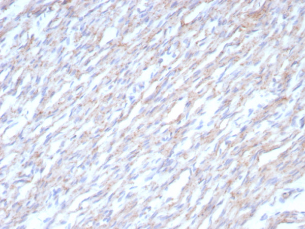 Anti-N-Cadherin / Cadherin-2 / CD325 (NCAD), recombinant antibody, clone CDH2/8862R