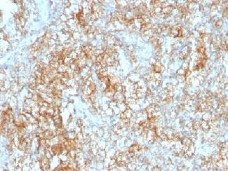 Anti-CD147 / Emmprin / Basigin, clone 8D6