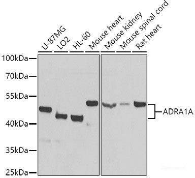 Anti-ADRA1A