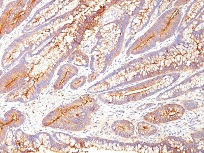 Anti-CD66 (CEA)(COL-1), CF405S conjugate, 0.1mg/mL