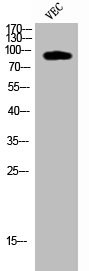 Anti-Cleaved-COL1A2 (G1102)