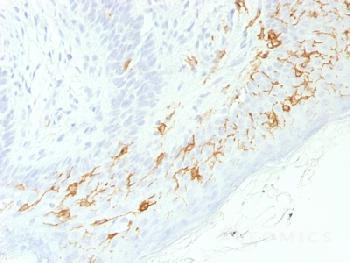 Anti-CD1a / HTA1 (Mature Langerhans Cells Marker) (clone: C1A/1506R) (recombinant rabbit monoclonal)