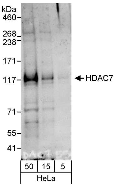 Anti-HDAC7