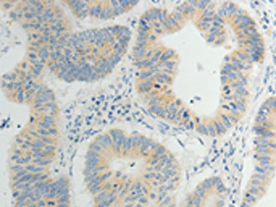 Anti-TP53BP2