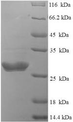 Spike glycoprotein (S), partial, Bovine coronavirus, recombinant