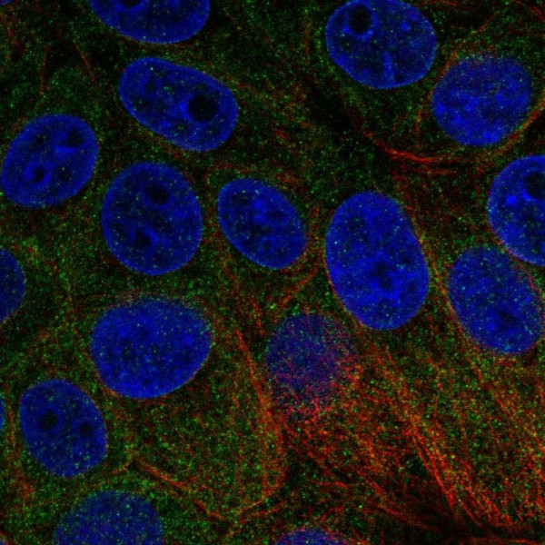 Anti-BNIP1
