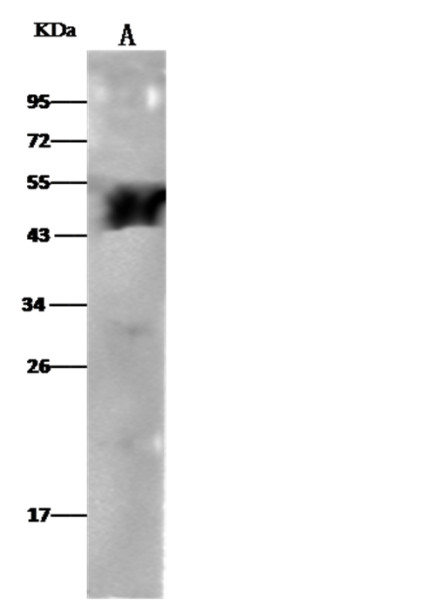 Anti-ALDH3A1 Monoclonal Recombinant Antibody