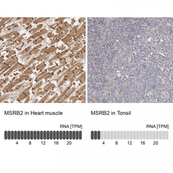 Anti-MSRB2