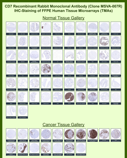 Anti-CD7 (T-Cell Leukemia Marker), recombinant antibody, clone MSVA-007R