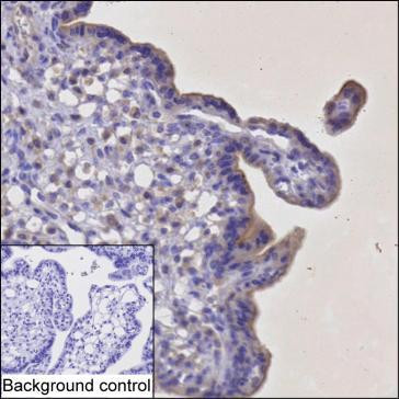 Anti-Interferon gamma Receptor 1