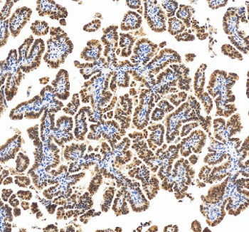 Anti-RBM17 / RNA-binding motif protein 17 / Splicing factor 45