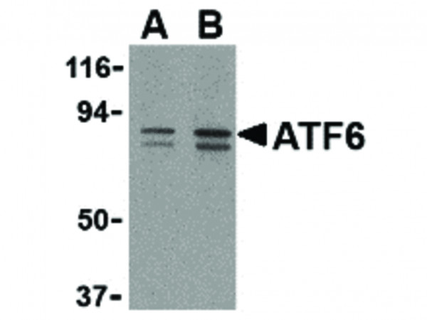 Anti-ATF6