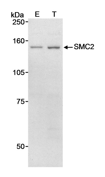 Anti-SMC2