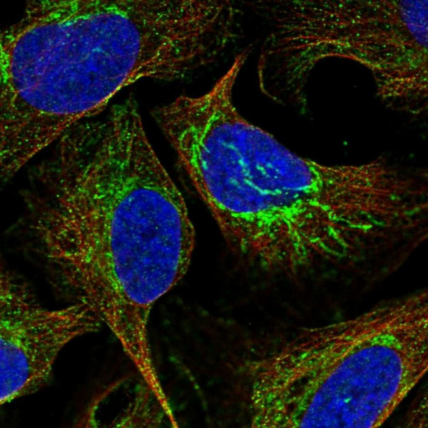 Anti-ATP5J
