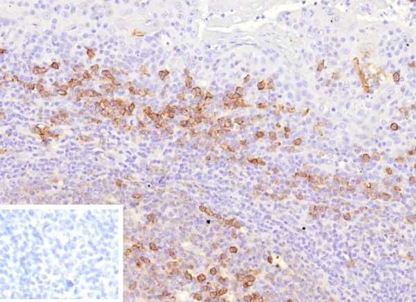 Anti-CD38 (ADP Ribosyl Cyclase I), clone CD38/9332