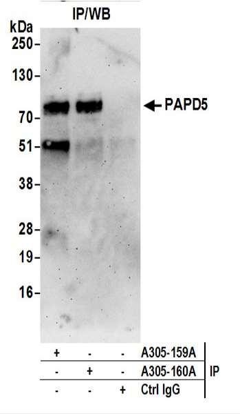 Anti-PAPD5/TRF4-2