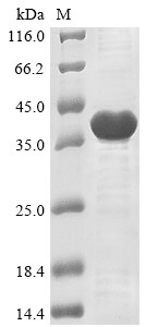 Dolichyl-phosphate-mannose--protein mannosyltransferase 3 (PMT3), partial, Saccharomyces cerevisiae,