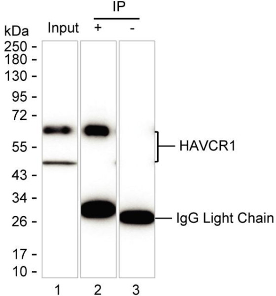 Anti-HAVCR1