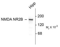 Anti-NMDAR2B