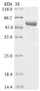 Angiopoietin-1 (Angpt1), rat, recombinant