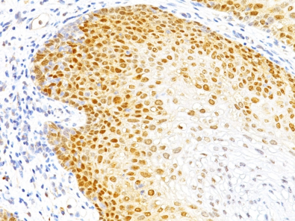 Anti-p27Kip1 (Mitotic Inhibitor/Suppressor Protein), clone DCS-72.F6