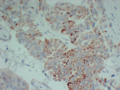 Anti-TGFBR2 / TGF beta Receptor II