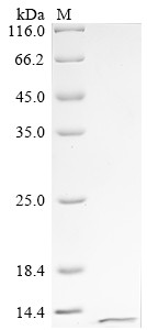 Fragile X mental retardation syndrome-related protein 1 (FXR1), partial, human, recombinant