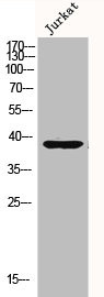 Anti-DUSP1