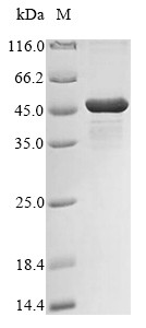 UDP-3-O-acyl-N-acetylglucosamine deacetylase (lpxC), Klebsiella pneumoniae, recombinant