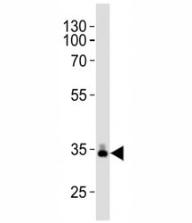 Anti-ApoE (Apolipoprotein E)
