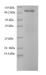 Stress-induced-phosphoprotein 1 (STIP1), human, recombinant