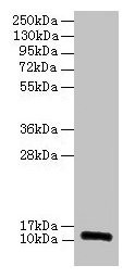Anti-RPLP1