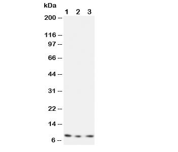 Anti-CX3CL1